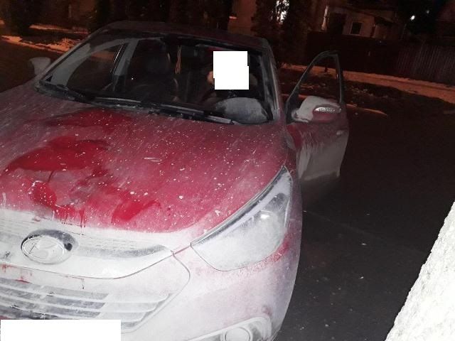 В Ставропольском крае в ДТП пострадала школьница В Ставропольском крае в ДТП пострадала школьница