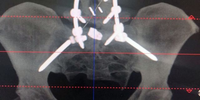 Ставропольские врачи освоили новую технологию лечения позвоночника Ставропольские врачи освоили новую технологию лечения позвоночника
