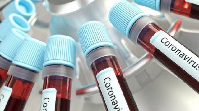 На Ставрополье от коронавируса излечились больше 50% всех заболевших На Ставрополье от коронавируса излечились больше 50% всех заболевших