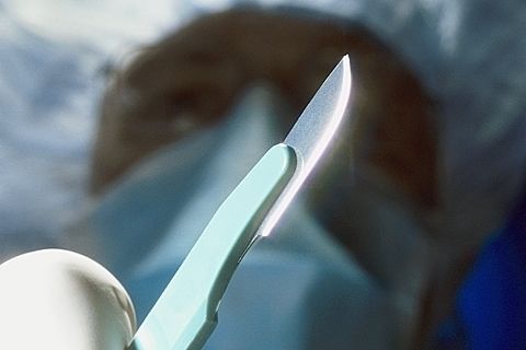 Ученый из Ставрополя придумал скальпель, который не оставляет рубцы Ученый из Ставрополя придумал скальпель, который не оставляет рубцы