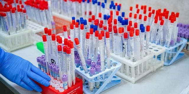Почти 100 человек заболели коронавирусом за сутки на Ставрополье Почти 100 человек заболели коронавирусом за сутки на Ставрополье