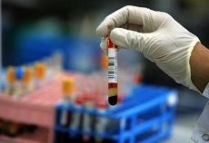 На Ставрополье резко увеличилось число ВИЧ-инфицированных На Ставрополье резко увеличилось число ВИЧ-инфицированных