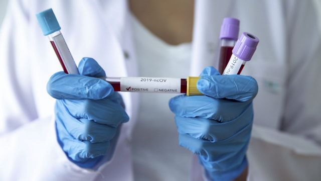 За прошедшие сутки на Ставрополье выявлено 114 новых случаев заражения коронавирусом За прошедшие сутки на Ставрополье выявлено 114 новых случаев заражения коронавирусом