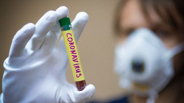 За последние сутки коронавирус выявили ещё у 237 ставропольцев За последние сутки коронавирус выявили ещё у 237 ставропольцев