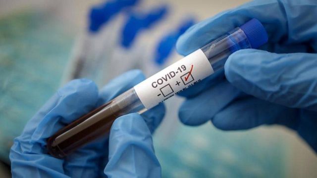 За сутки на Ставрополье выявлено 90 новых случаев заражения коронавирусом За сутки на Ставрополье выявлено 90 новых случаев заражения коронавирусом