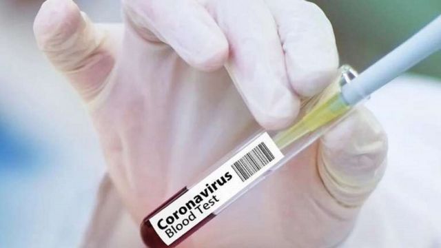 К 24 января на Ставрополье выявлен 241 новый случай заражения коронавирусом К 24 января на Ставрополье выявлен 241 новый случай заражения коронавирусом