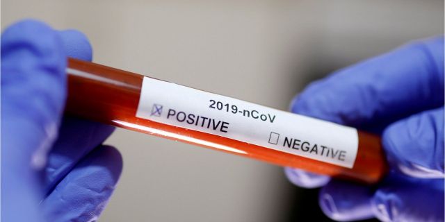 Минздрав СК: на Ставрополье никто не умер от нового вируса nCoV-2019 Минздрав СК: на Ставрополье никто не умер от нового вируса nCoV-2019