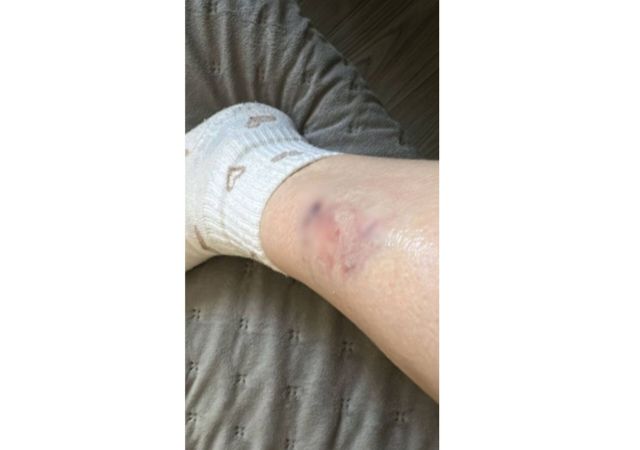 Собака напала на жительницу Ставрополья