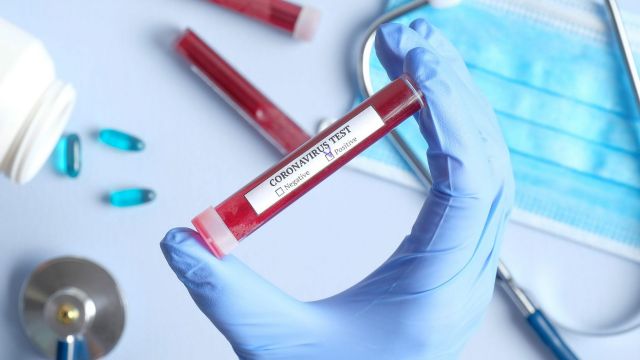 За последние сутки на Ставрополье коронавирус выявили ещё у 41 человека За последние сутки на Ставрополье коронавирус выявили ещё у 41 человека