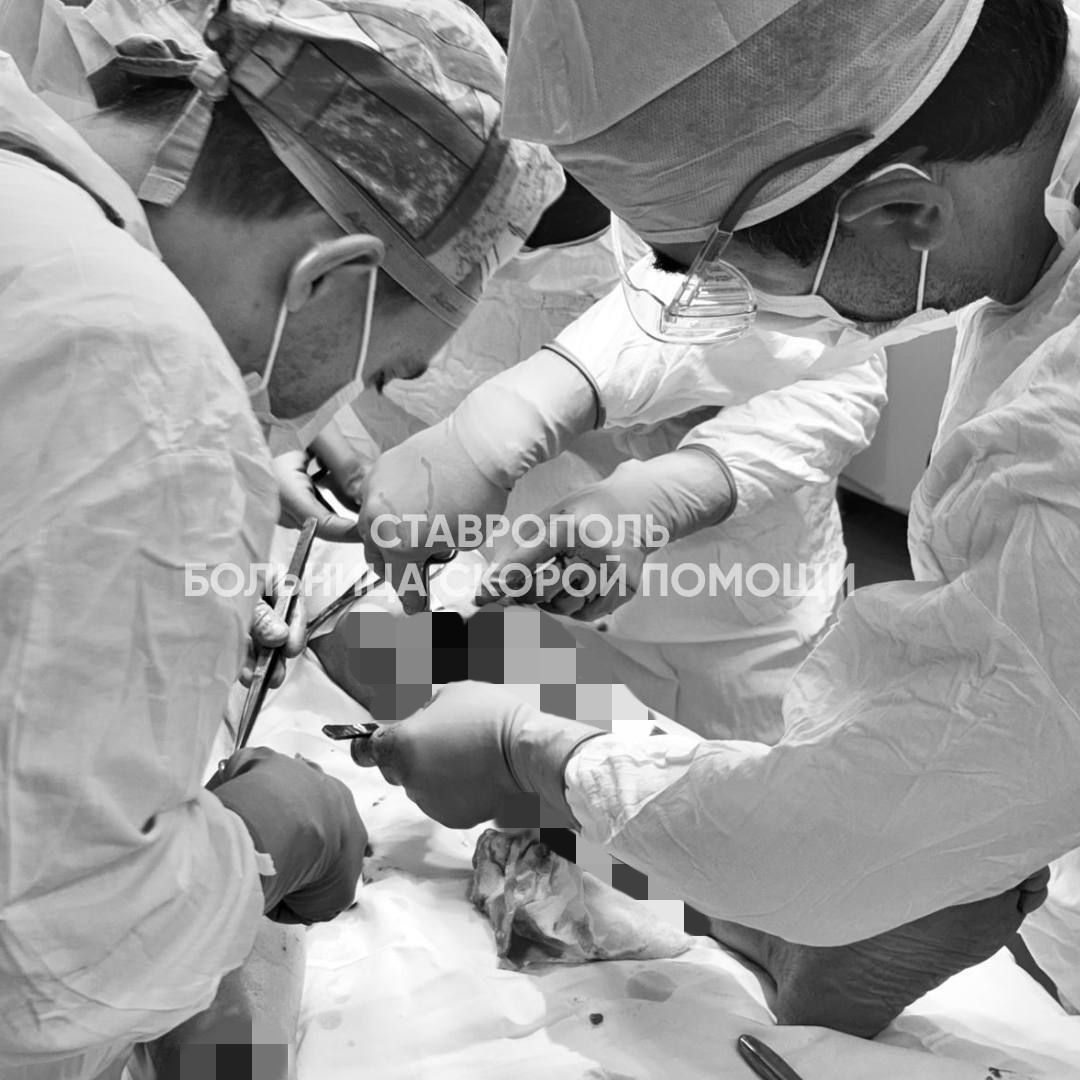 Ставропольские врачи собрали по кусочкам ноги женщины, попавшей под грузовик