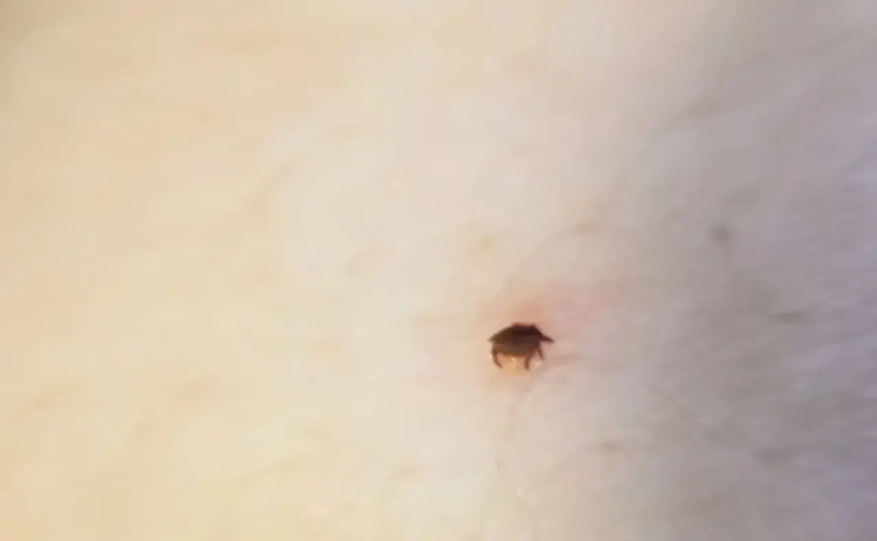 На Ставрополье клещи покусали почти 500 человек