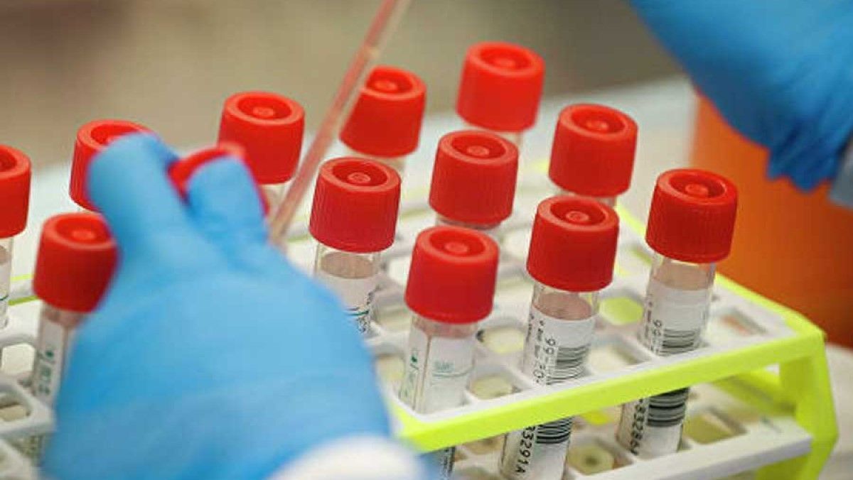 Ещё 62 ставропольца заболели коронавирусом за последние сутки