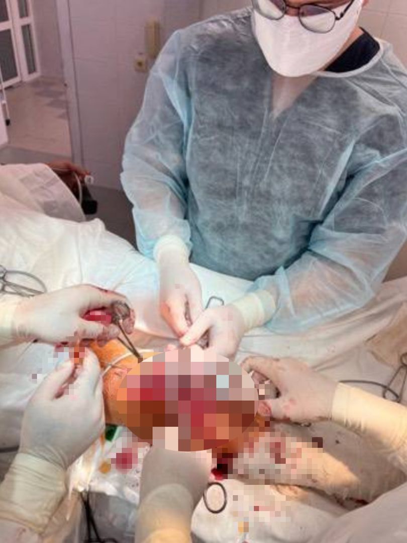 Ставропольские врачи спасли ногу пострадавшему в ДТП