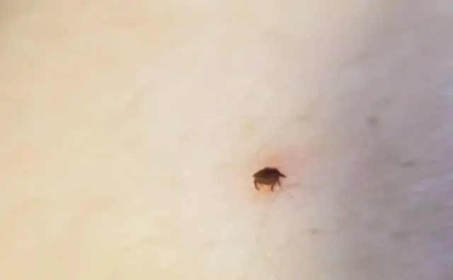 На Ставрополье клещи покусали почти 500 человек