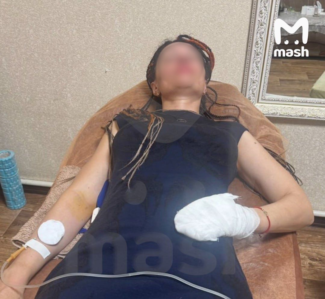 Ставропольчанке ампутируют палец из-за обморожения при восхождении на Хан-Тенгри
