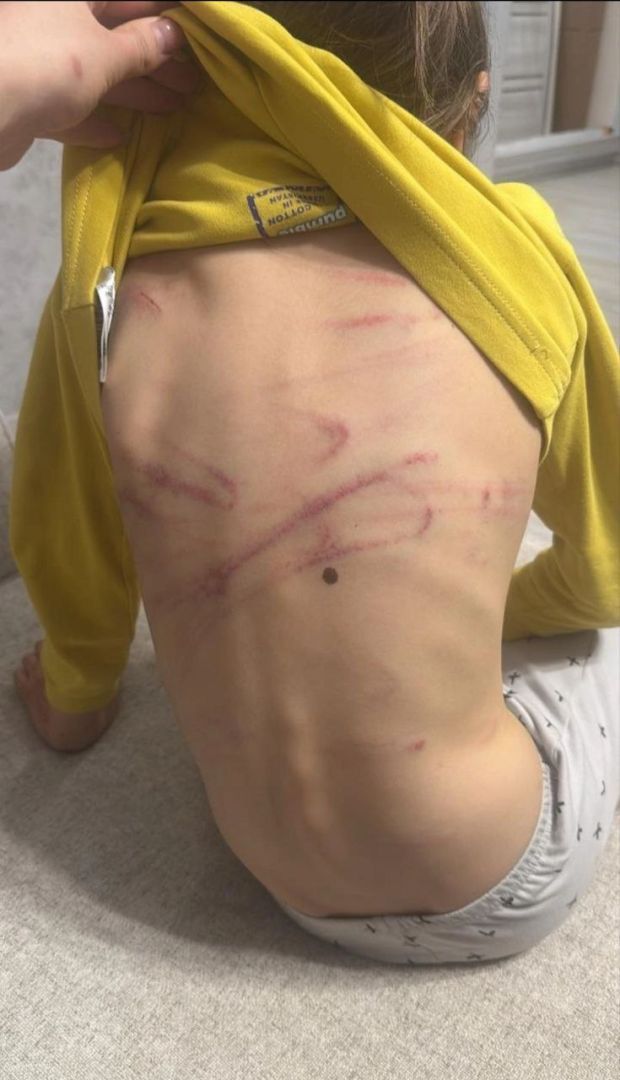 В Кисловодске расследуют нападение детей на 8-летнюю девочку