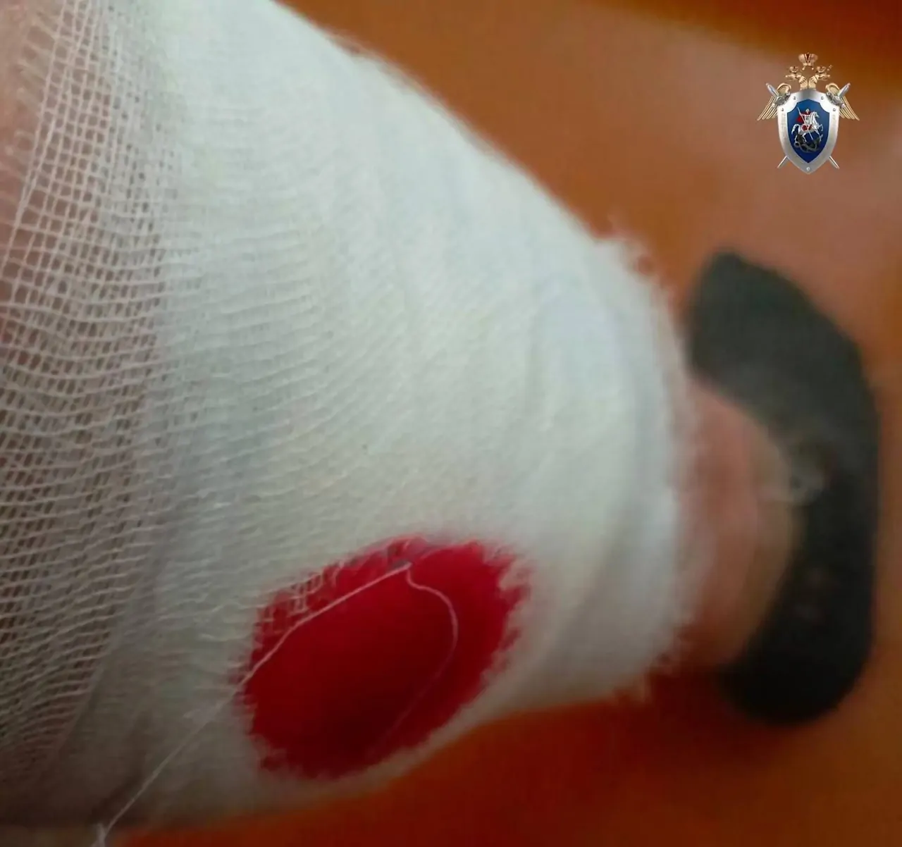 Бездомные собаки напали на женщину в Минеральных Водах