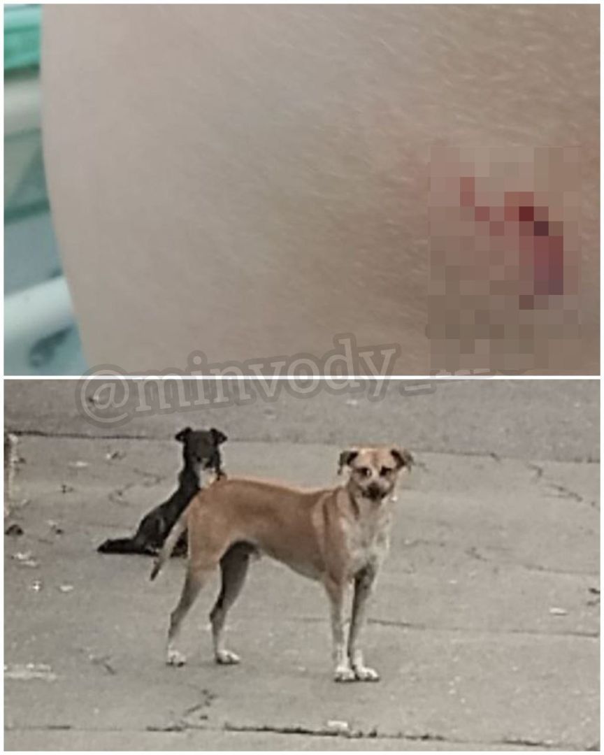 Бездомная собака укусила школьницу в Минводах