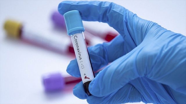 62 ставропольца заболели коронавирусом за последние сутки 62 ставропольца заболели коронавирусом за последние сутки