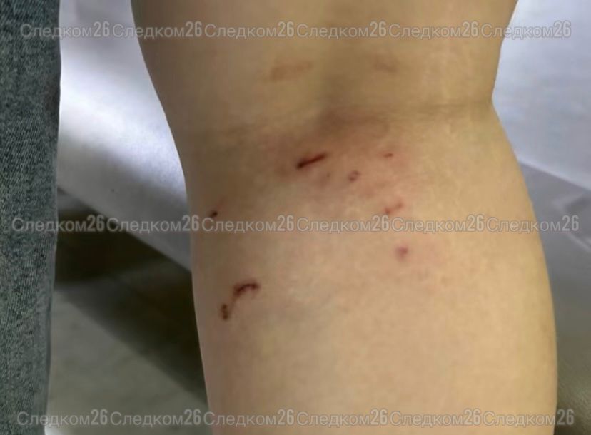 Стая бродячих собак напала на ребёнка в Минводах: возбуждено дело о халатности