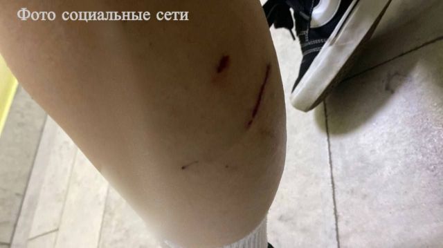 Бездомные собаки напали на 16-летнюю жительницу Минеральных Вод