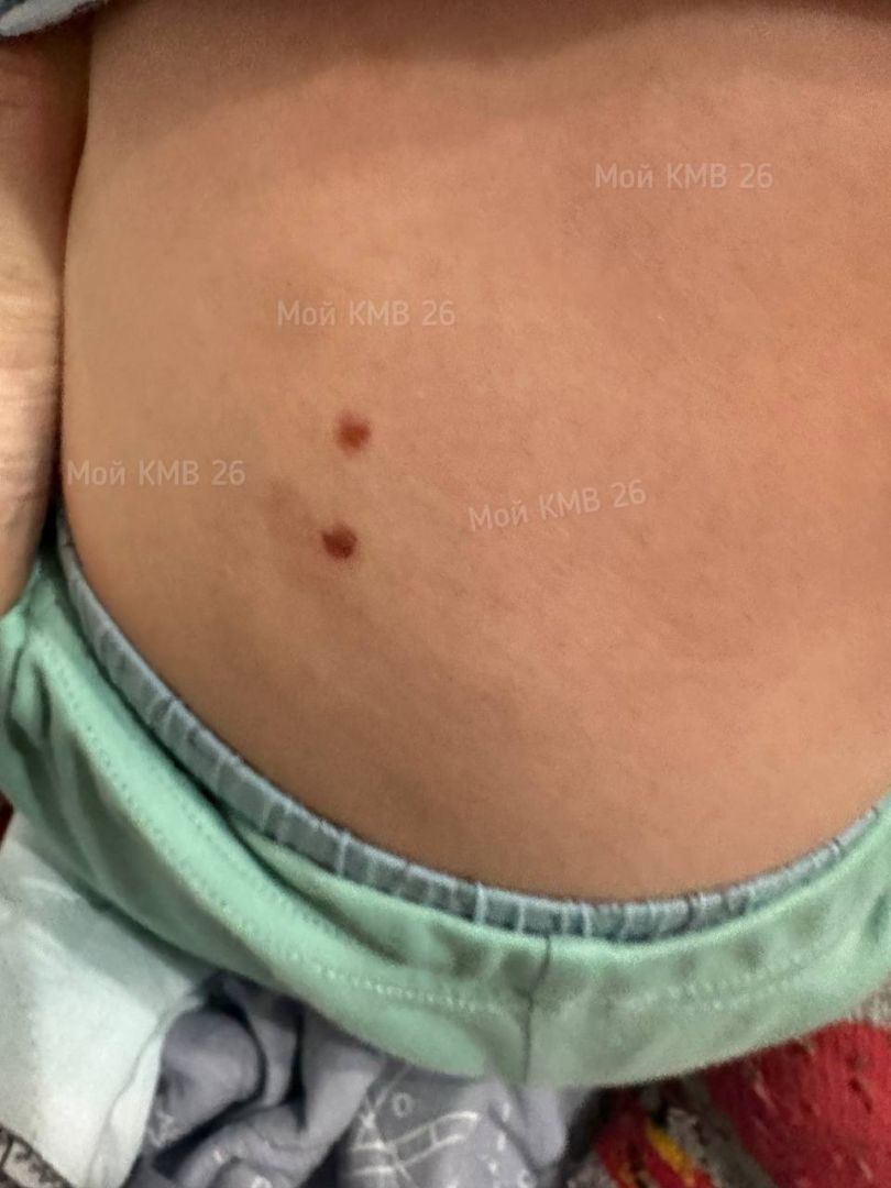 Бастрыкин взял на контроль дело о насилии над детьми в ставропольском детсаду