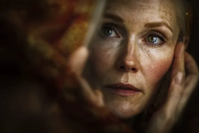 Причины появления пигментных пятен — объясняет врач-дерматолог